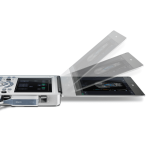 Acclarix AX2 Sistema de diagnóstico por ultrasonidos | EDAN - Imagen 2