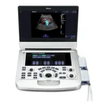 Acclarix AX3 Sistema de diagnóstico por ultrasonidos | EDAN